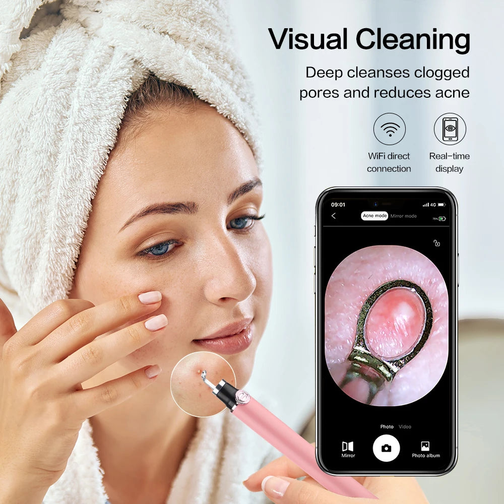 Smart Visual Blackhead Remover with Camera